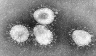 Tes Lab Ungkap Kemampuan Bertahan Virus Covid-19