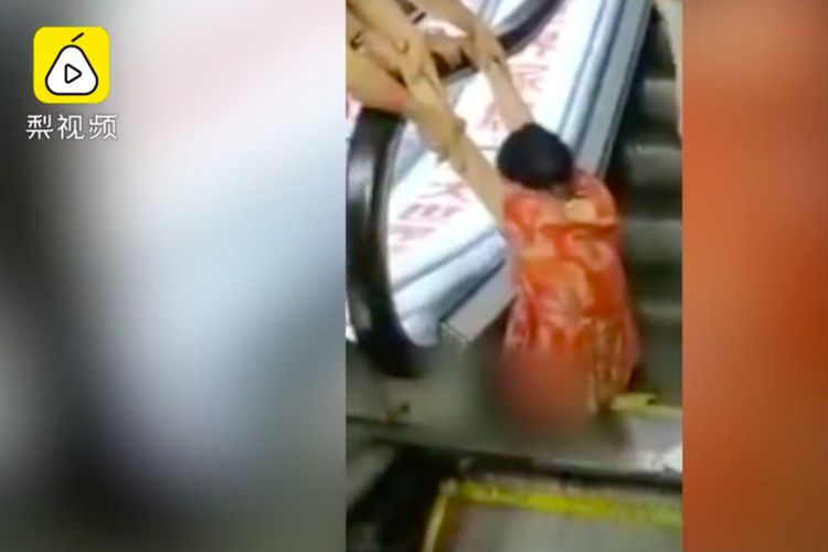 Kaki Kirinya Hancur Terjebak di Eskalator, Wanita Ini Malah Disalahkan