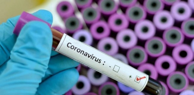Jubir Corona: Klorokuin Hanya Untuk Pengobatan, Bukan Pencegahan