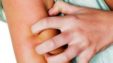 Cukup Tempelkan Kulit Pisang, Gatal di Kulit Hilang Seketika
