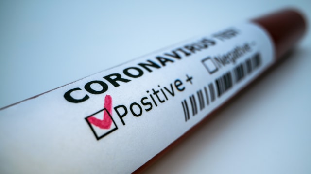 Singapura Umumkan 23 Kasus Baru Positif Corona, 2 di Antaranya WNI