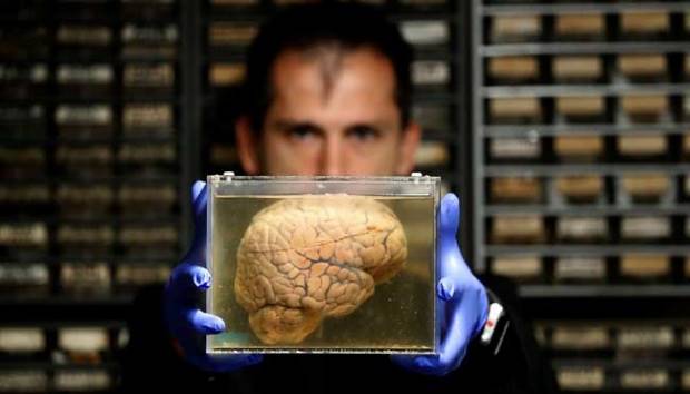 Gen Rahasia di Balik Otak Manusia