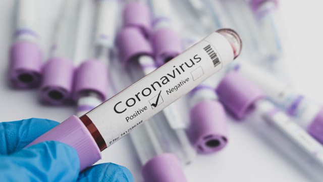 35 Napi di Lapas Perempuan Gowa Positif Corona