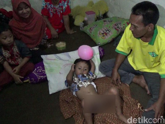 Bocah di Banyuwangi Ini Disunat Jin, Benarkah?